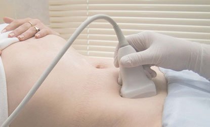 gynae-image-2